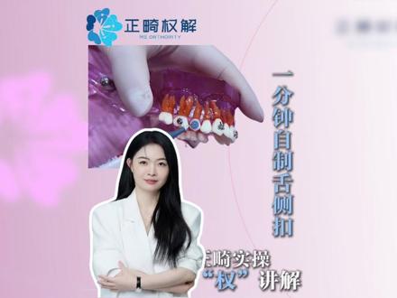权香莲老师教你一分钟学会自制舌侧扣,该省省该花花~ #正畸 #正畸学习 #正畸权解 #正畸权解权香莲