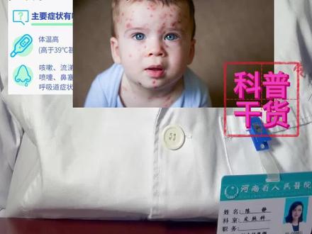 流感会引起皮疹吗?发疹子说明得了流感吗?#甲流进入高发期 #医学科普 #越早知道越好