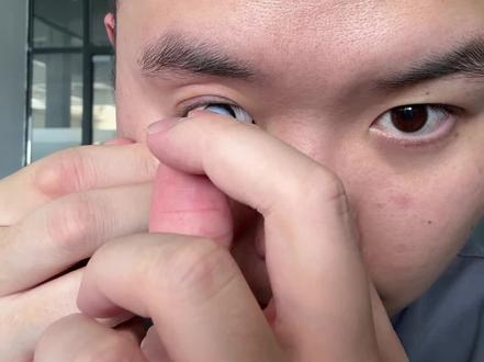 #蜕变过程 #义眼 义眼使用展示