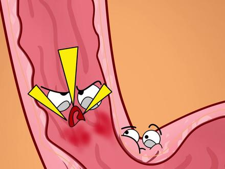 胃反酸可要注意 #充能计划 #轻漫计划 #我在抖音看动漫 #二次元原创