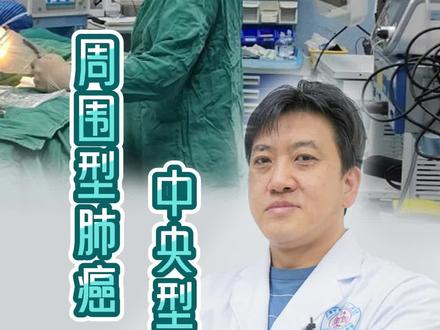 周围型肺癌、中央型肺癌都很严重吗?预后好不好#周围型肺癌 #中央型肺癌 #肺癌 #门诊故事