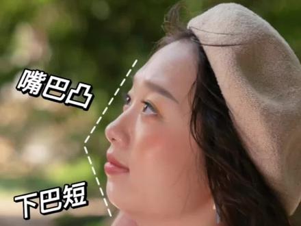 凸嘴女孩侧颜逆袭!嘴不秃了真的敲好看!#变美逆袭