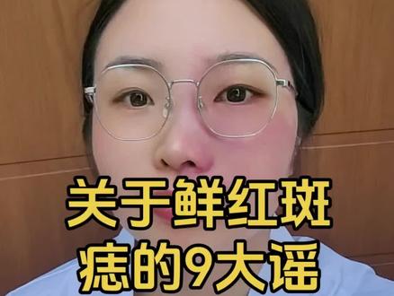 作为一名有鲜红斑痣(红胎记)患者的本尊,又是一名医务工作者,关于“胎记”的一些谣言,我是有绝对发言权的。