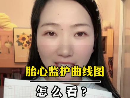 胎心监护曲线图怎么看?来来来,收藏起来慢慢看#新手爸妈必看 #亲测分享 #找对方法很重要 #希望对你有所帮助 #每天坚持会有不一样的收获