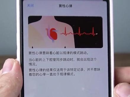 一分钟,帮你了解AppleWatch心电图功能。有多大价值?能辅助、代替医院检测结果吗?#ecg #苹果 #watch7