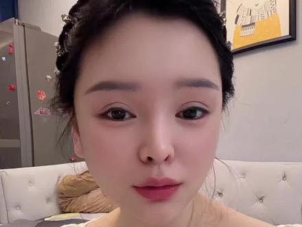 我不同意雪饼猴上班,猴粉们支持不?@王铁柱(雪饼猴🐒) #雪饼猴 #雪饼猴受伤 #雪饼猴王铁柱 #长春动植物公园