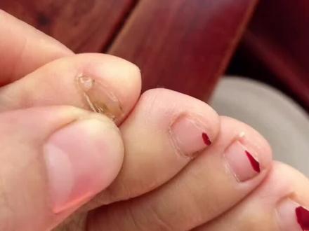 我们是广西人#两瓣甲 #人家的脚丫子