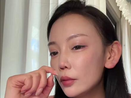 千万别乱做鼻子👃!我用🩸泪告诉你真相#做鼻子的后遗症 #理性变美 #鼻子塌 #鼻子护理 #亲身经历的真实故事