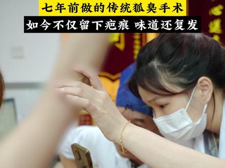 七年前大切口腋臭术后,异味和疤痕双重困扰 #腋臭 #狐臭 #腋臭医生王峰 #狐臭手术