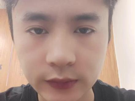 苹果手机微信视频模糊解决办法,苹果手机视频模糊通病#长相差了点但气质不能输