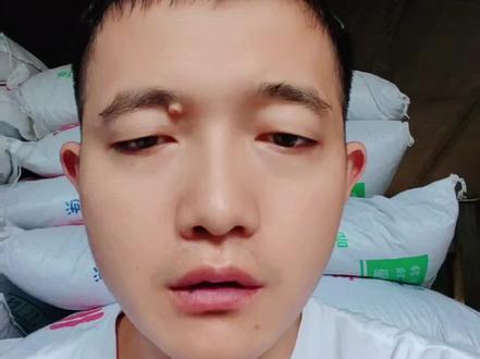 最近问我锚头蚤的特别多,这里聊聊我的个人理解#鱼塘 #养殖人 #水产养殖 #锚头蚤 #水产