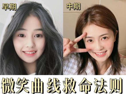 微笑曲线救命法则#白鹿 #白月梵星 #牙贴面 #整牙 #白鹿my