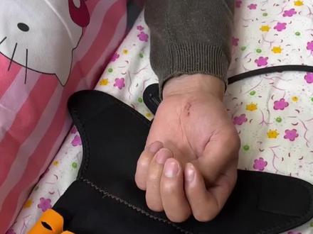 脑梗手指康复训练#康复训练 #守护健康 #知识分享