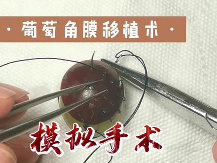 葡萄的手术:角膜移植术 #外科手术 #外科缝合 #外科医生 #科普健康知识
