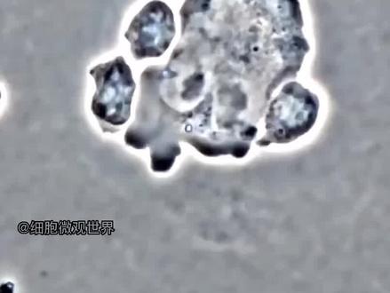 NK细胞是免疫系统重要的自然杀伤细胞,不需要特异性的抗原刺激就可以杀伤靶细胞,如病毒感染细胞、肿瘤细胞等。#NK细胞#细胞#免疫细胞#健康#免疫力