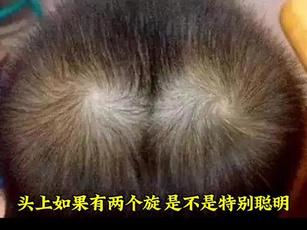 头上两个“旋”代表什么
