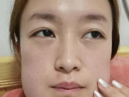 针对广大网友提出的问题 一一作出解答! 可都别在笑我了!
#真的笑不出来 #拔智齿 #蜜蜂小狗