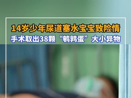 14岁少年因好奇往尿道塞水宝宝,膀胱险“炸”, 手术取出38颗,最大的像“鹌鹑蛋”。#异物取出 #水宝宝危险 #医生提醒