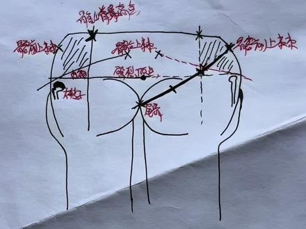 肌内注射定位方法解析~~^_^