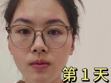 day52 | 普女挑战100天变成氛围感美女 慢慢来,比较快❤️
以上仅为个人打卡记录,效果因人而异。面部操及运动建议在专业指导下进行,无任何不良引导。🙏
#筷子操 #眼神操 #大小脸 #减肥 #颈纹