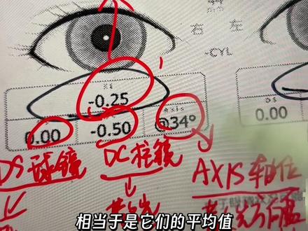 儿保的视力筛查怎么看?远视储备怎么查看?是否近视?一条视频教会你#视力筛查 #儿保科体检 #远视储备 #新手爸妈必看 #创作灵感