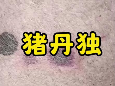 典型猪丹毒。 #所有养猪人 #猪丹毒怎么治