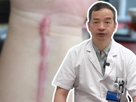 去上海九院修复疤痕!到底应该是挂什么科? #上海九院 #疤痕 #去疤 #上海九院董肇杨 #疤痕增生