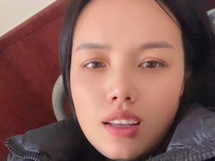 奥司他韦抗病毒虽好,但却有很多副作用,全被我亲身感受了