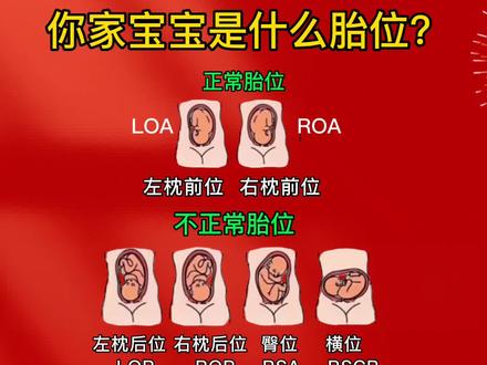 你家宝宝是什么胎位呢?#怀孕 #孕妈#产检一路绿灯#育儿 #新生儿 @DOU+小助手 @DOU+上热门
