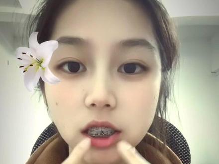 上条限liu了 重新发一次#脱矿 #牙套 #正畸 #牙齿矫正 #牛牛大王牙套记