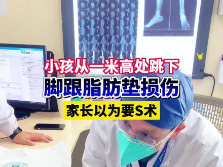 小孩从一米高处跳下脚跟脂肪垫损伤#医学科普 #儿童骨科医生 #医生日常 #脂肪垫 #脂肪垫损伤 #脚跟疼 #父母必看系列