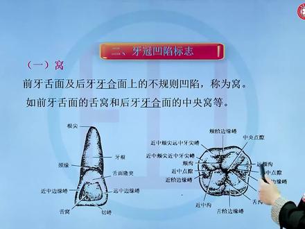 口腔执业含助理—口腔解剖生理学:牙冠凹陷标志#口腔科普 #医学生 #医学知识科普
