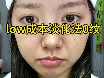 关于法令纹说说我个人的经验,详细如下~#法令纹#淡化法令纹#女大一#女生必看