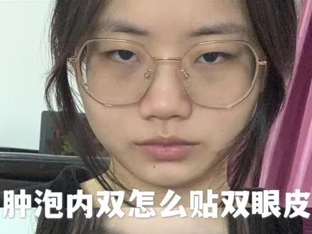 肿泡内双0失败|四年了都是用的这个方法