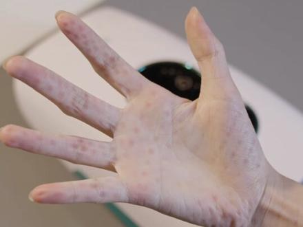 给双手放个假,把这疲惫交给这位#手部按摩仪 ,真的会很放松#北健 #键盘手 #按摩 #科技