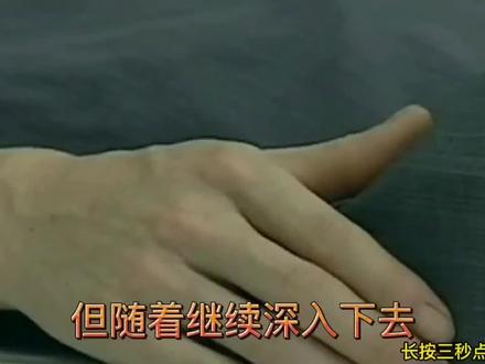 男子体内取出29根钢针,怎么进入体内的?背后隐秘让人身体发凉!下 #离奇故事 #心理健康 #家庭教育