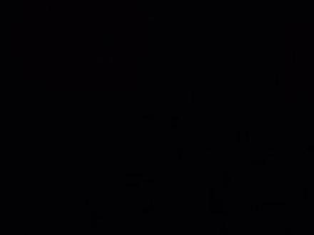 #祛斑 在一月中旬去医院激光祛斑,突然翻到了之前看效果的图片就记录一下,当时只为了看效果自行忽略我的容貌😂,之前一些祛斑的化妆包也试过,美容院也去过,最后发现还是医院靠谱,有问题直接去医院,少花冤枉钱😂