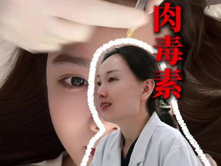肉毒素:从“毒”到“药”的华丽变身,你真的了解它吗? #皮肤 #医美 #抖出健康知识宝藏