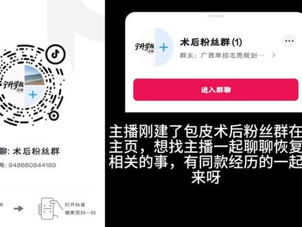 包皮手术第1天 #弱小可怜又无助 #苞皮手术 #割皮日记 #手术备皮 #切皮手术