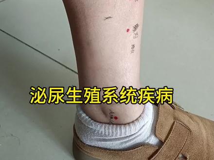 内容仅供参考如有不适线下就医