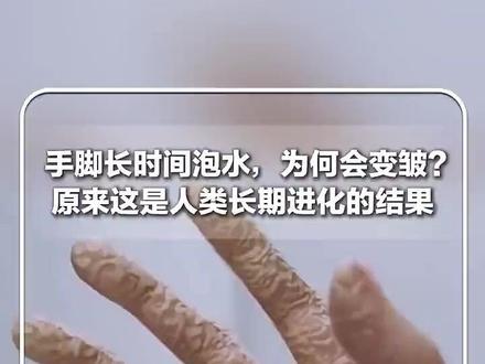 手脚长时间泡水,为什么皮肤会变皱?原来这是人类长期进化的结果。网友:解开了我多年的困惑!