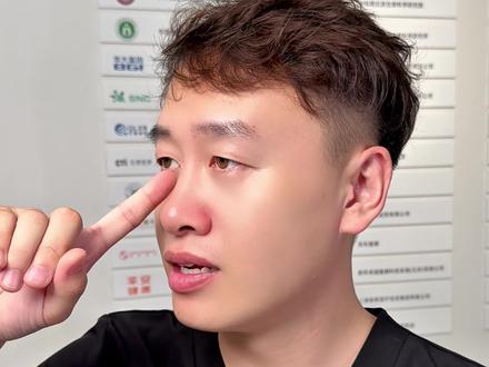 山根低 鼻梁塌#山根低 #鼻梁低 #面部提升