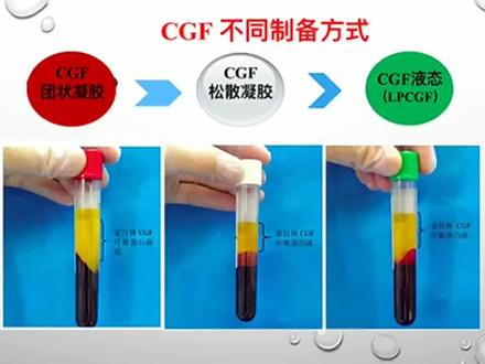 CGF的制备讲解#牙齿正畸 #正畸 #牙医 #牙齿矫正