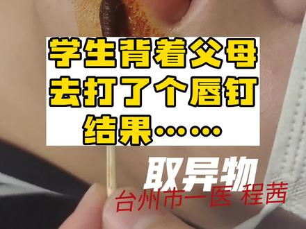 打唇钉?请三思!#医学科普 #唇钉 #内容过于真实 #创作灵感@台州市第一人民医院 @抖音小助手 @创作灵感小助手