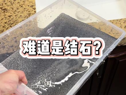 这些小黑点不会是结石吧?难道是真有病了?得去碎石了?