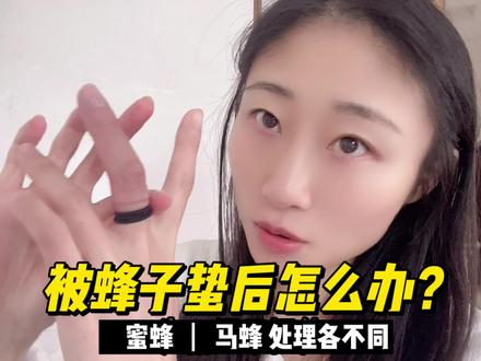 被蜜蜂、马蜂蛰了怎么办?