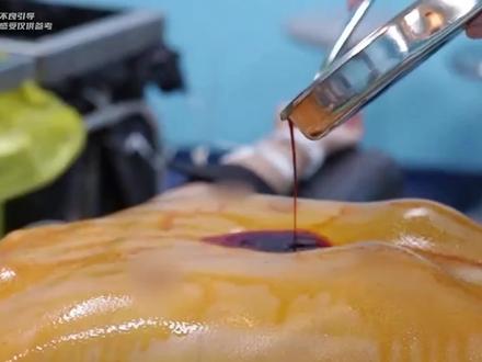 原来碘伏还样的妙用! #口腔异味 #碘伏 #聚维酮碘