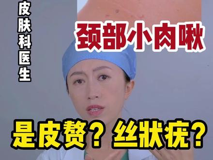 颈部小肉粒到底是皮赘还是丝状疣?皮赘该涂什么药膏?千万别搞错了!!!#dou来说健康 #皮赘涂什么药膏 #丝状疣 #皮赘 #皮赘和丝状疣区别