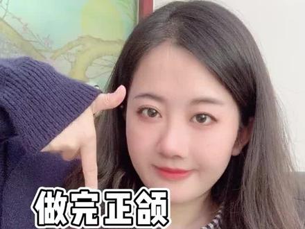 关于做完正颌出现的7个“后遗症”问题