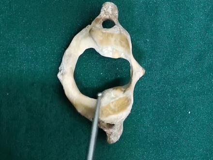 寰椎各部解剖名称